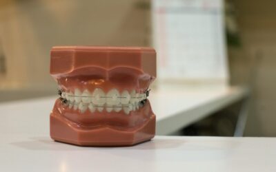 Injerto de encía: Tipos, procedimiento y beneficios clave
